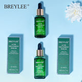 BREYLEE Tratamento de Acne Máscara de Sérum Facial Anti Acne Removedor de Cicatrizes Hidratante Clareamento Cuidados com a Pele Creme Essência Facial 17ml